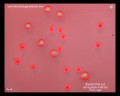 escherichia coli appearance